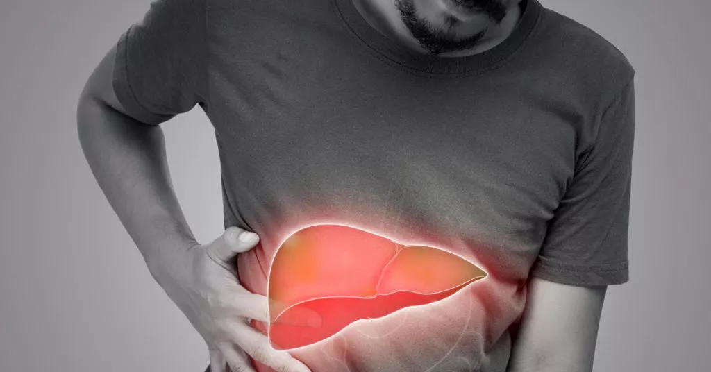 FattyLiver