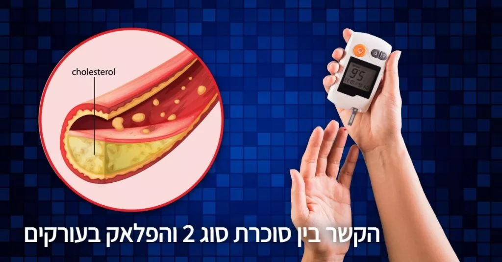הקשר בין סוכרת סוג 2 והפלאק בעורקים